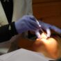 Getting NHS Coverage for Orthodontic Treatment in Camden